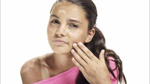 photo-peeling-acide-glycolique-benefique-pour-la-peau