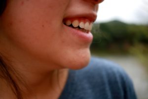 photo-peeling-doux-acide-salicylique